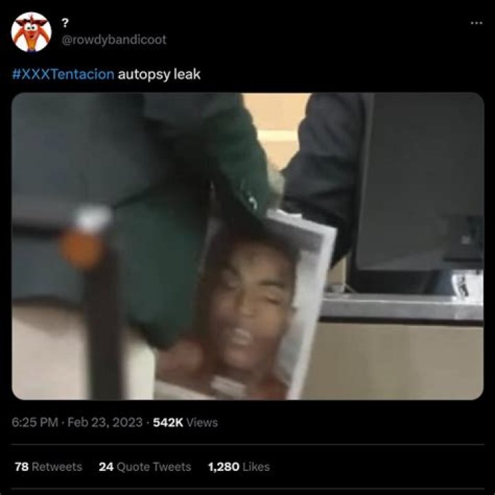 Xxxtentacion autopsy picture, like King Von’s, leaked on Reddit and Twitter, fan Scott Barbieux questioned